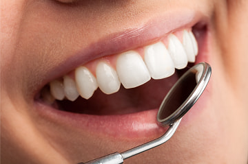Dental Teeth Whitening