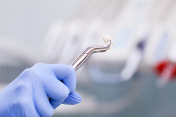 Dental Tooth Extraction